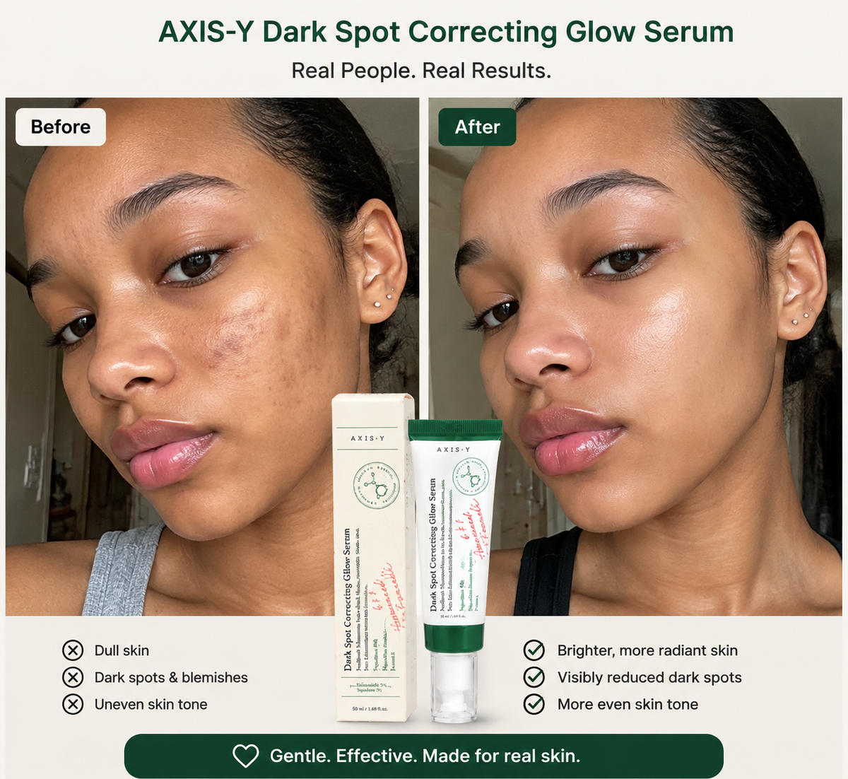 AXIS-Y Dark Spot Correcting + Eye Serum – 2-Piece Glow Set