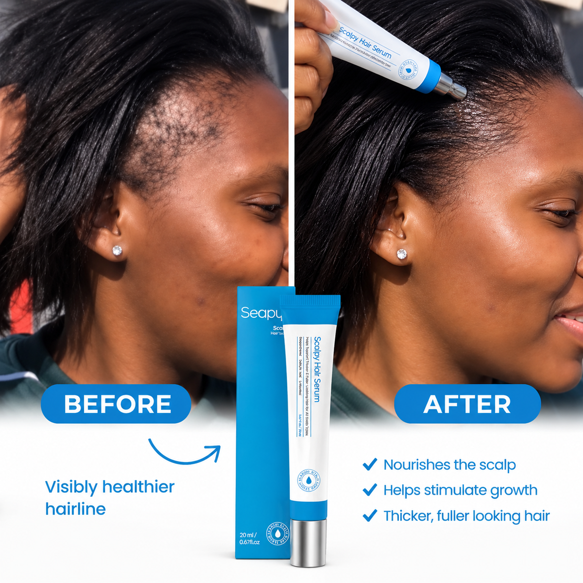 Scalpy Hair Growth Serum for Hair Care
