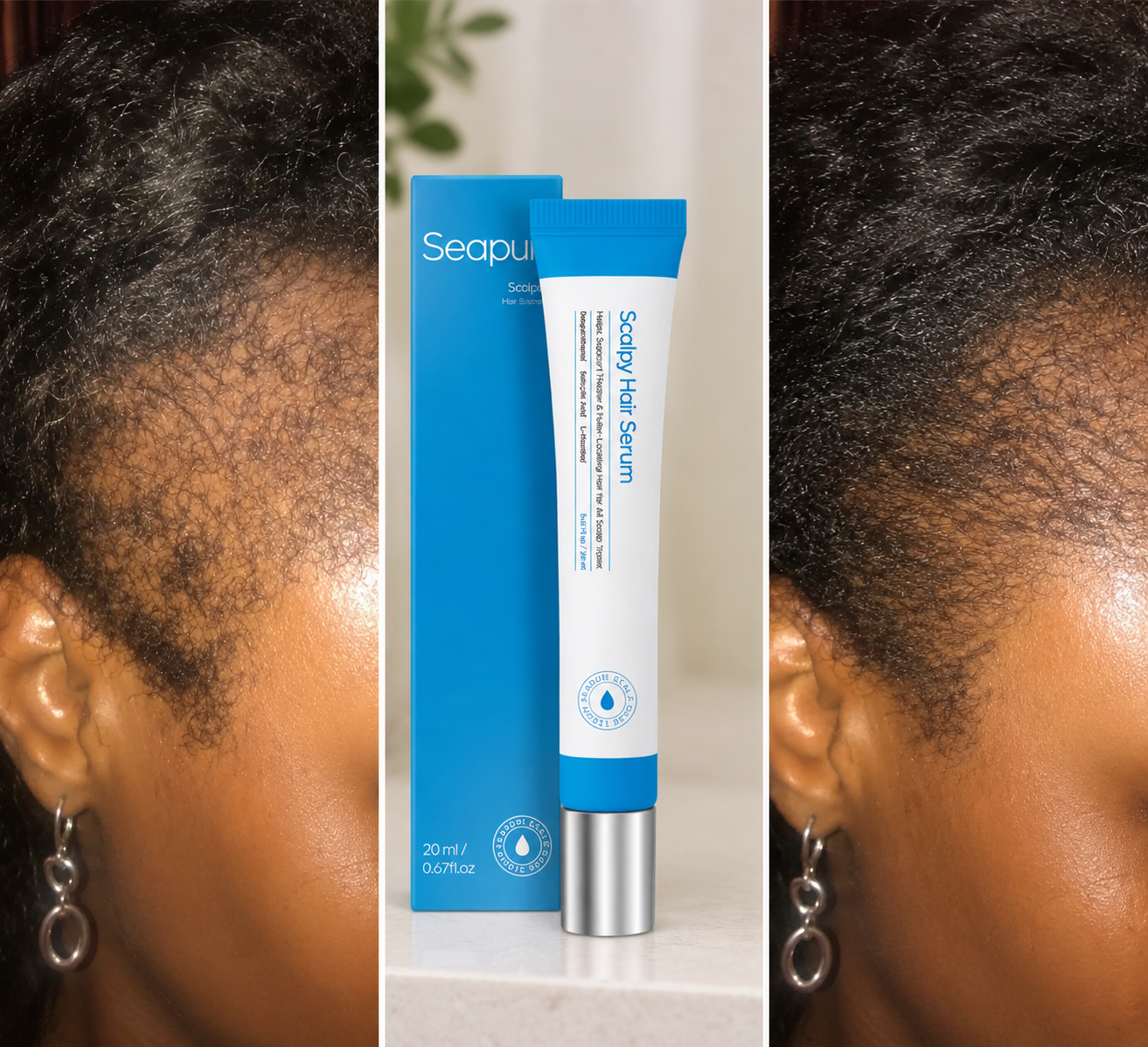 Scalpy Hair Growth Serum for Hair Care